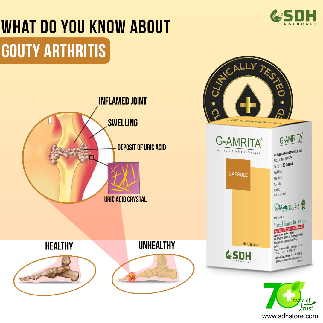 SHREE DHANWANTRI HERBALS Naturals G Amrita Helps In Gout,Joint Pain Relief By Healthy Uric Acid Level,Helps Reduce Swelling&Pain,Natural Supplement For Joint Care , Ayurvedic Tablets