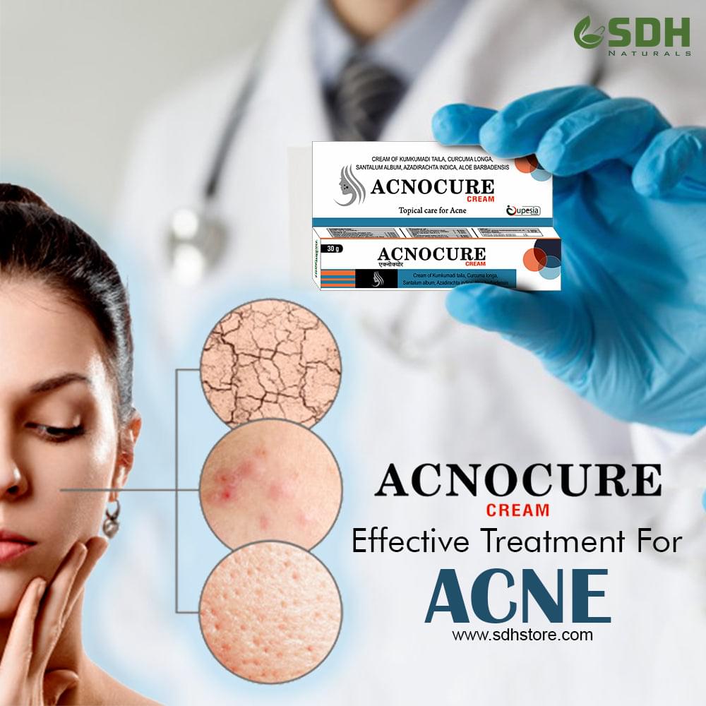 Acnocure Cream SDH Naturals